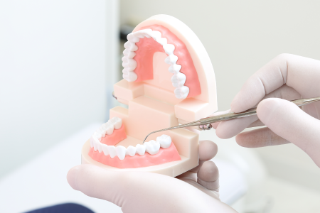 歯周外科（再生療法）