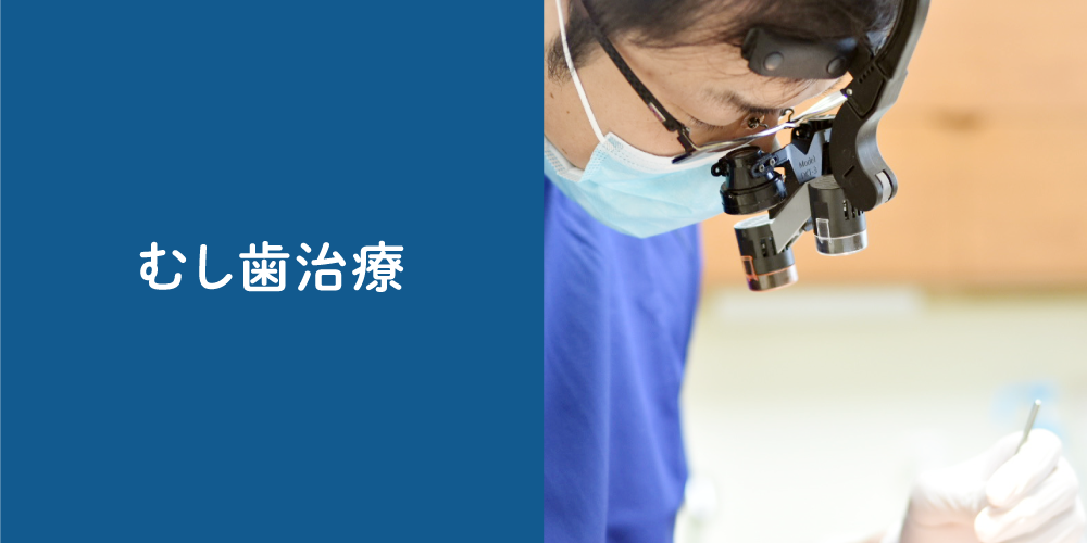 むし歯治療