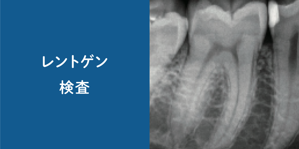 レントゲン検査